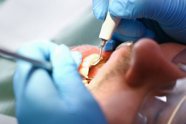 Best Emergency Broken Tooth Repair in Destin, FL
